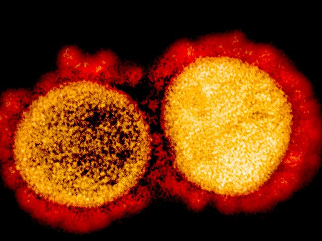 This undated handout image obtained August 11, 2020, courtesy of the National Institute of Allergy and Infectious Diseases(NIH/NIAID), shows a transmission electron micrograph of SARS-CoV-2 virus particles, isolated from a patient,captured and color-enhanced at the NIAID Integrated Research Facility (IRF) in Fort Detrick, Maryland. - Although none of the coronavirus vaccines under development has proved its efficacy yet in clinical trials, at least 5.7 billion doses have been pre-ordered around the world. First shipments of a COVID-19 vaccine created by Western laboratories have often been snapped up by the United States.Five vaccines -- three Western and two Chinese -- are in Phase 3 efficacy trials involving thousands of people.In a surprise announcement, Russian President Vladimir Putin claimed on August 11, 2020 that a vaccine dubbed "Sputnik V" -- after the Soviet satellite -- conferred "sustainable immunity" against the novel coronavirus. (Photo by Handout / National Institute of Allergy and Infectious Diseases / AFP) / RESTRICTED TO EDITORIAL USE - MANDATORY CREDIT "AFP PHOTO /NATIONAL INSTITUTE OF ALLERGY AND INFECTIOUS DISEASES/HANDOUT " - NO MARKETING - NO ADVERTISING CAMPAIGNS - DISTRIBUTED AS A SERVICE TO CLIENTS