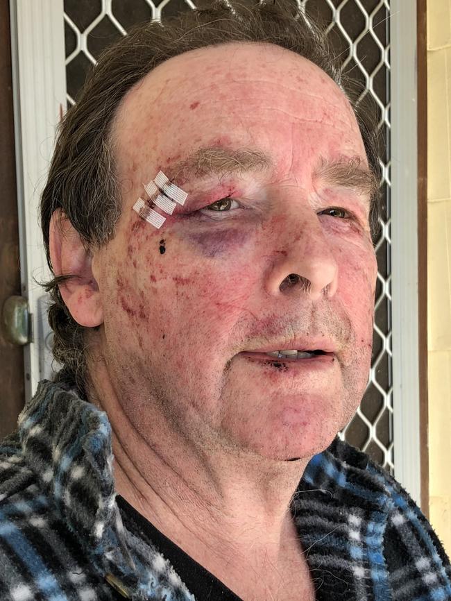 Graham Triffitt says he was allegedly attacked with a piece of wood and a hook from his shop.