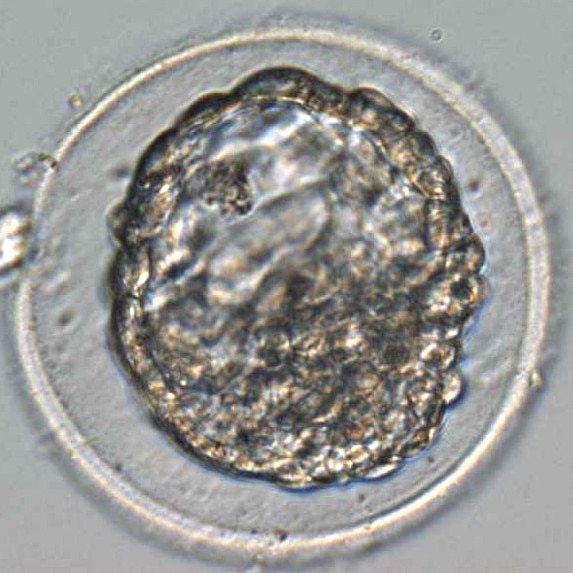 The embryo that became Charlotte. Picture: Supplied