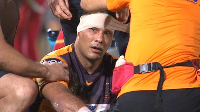 Justin Hodges gets bandaged.