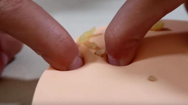This YouTube clip of the Pimple Popper in action made me feel ill. Credit: Maisies Toy World