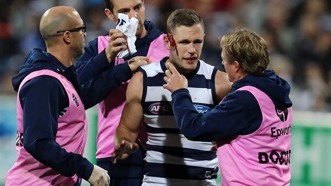 Joel Selwood left bloodied after charging back into a marking pack. Picture: Michael Klein