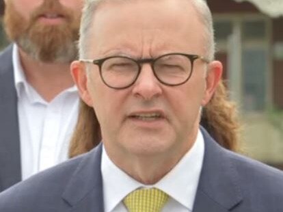 Albo’s hilarious ‘new look’ caught on camera