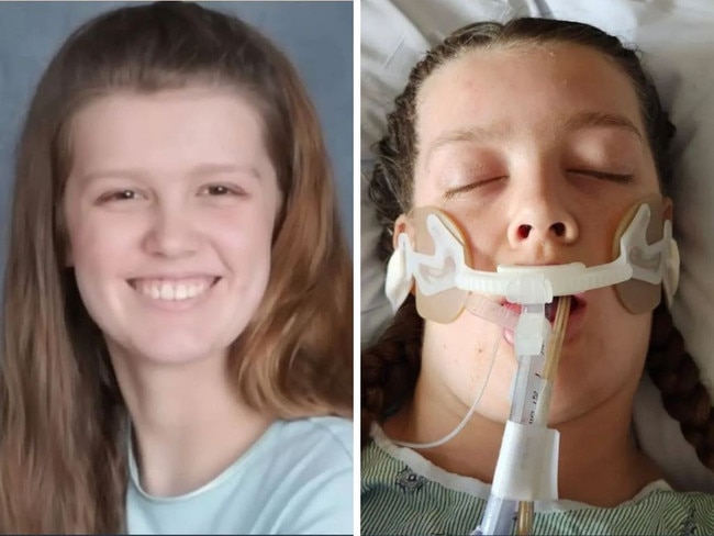 Teen dead after allergic reaction to brownie