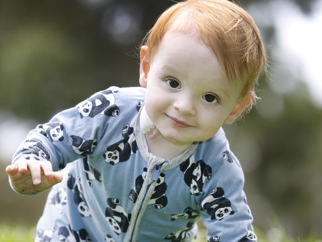 Good Friday Appeal Royal ChildrenÃs Hospital patients. Samuel Edwards 1, has an under developed lower bowl condition.                     Picture: David Caird