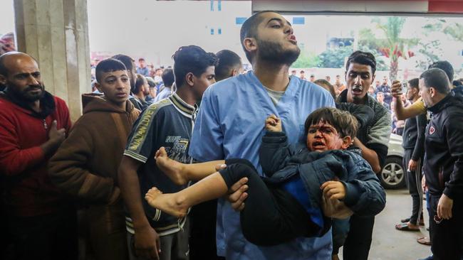 A child is severely injured from Israeli air strikes. Picture: Getty Images