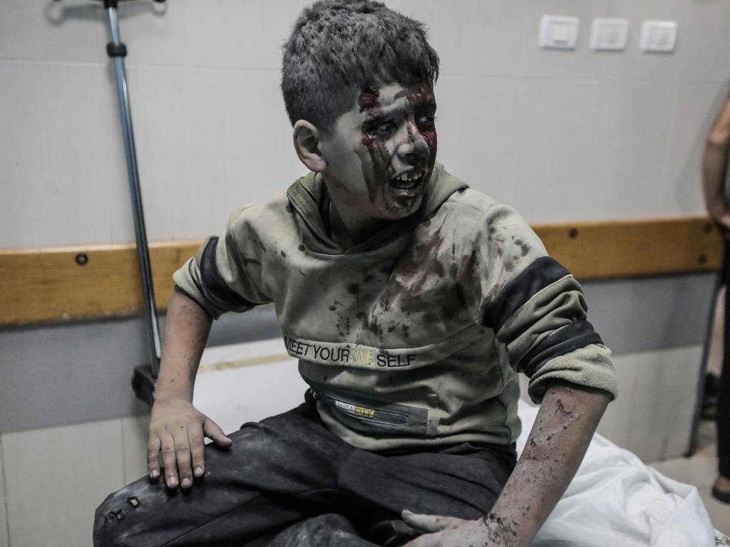 A young Palestinian boy injured in Israeli raids is treated at Nasser Medical Hospital in Khan Yunis, Gaza. Picture: Getty Images