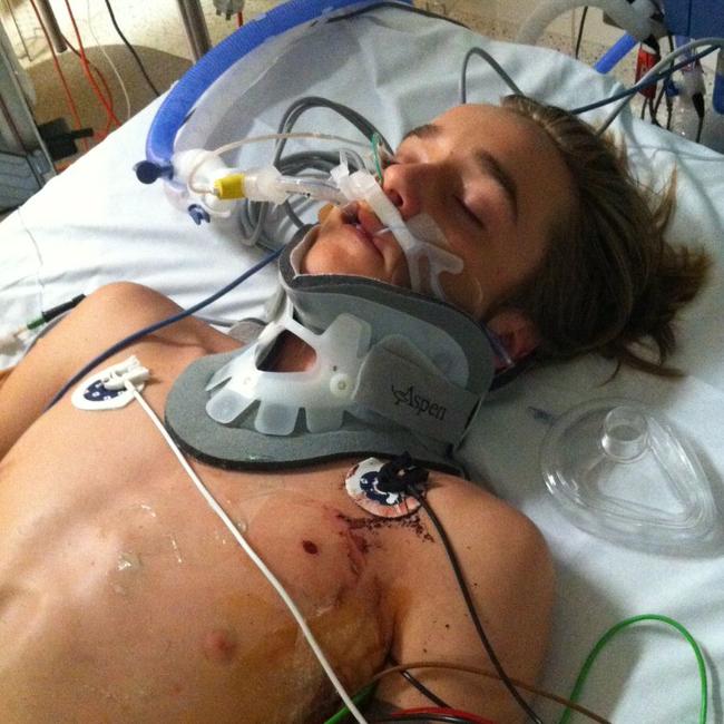 Ryan Meuleman after his accident.