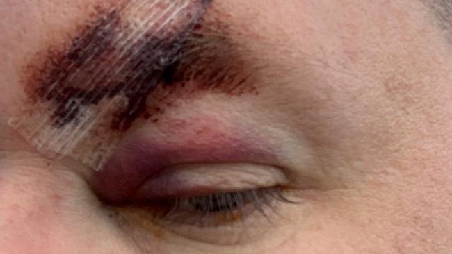 One of three police officers assaulted in Maitland following a vehicle stop. Credit: NSW Police