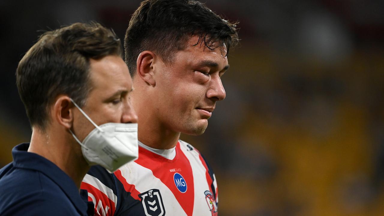 The injury isn’t as graphic as what happened in 2021. Picture: NRL Photos