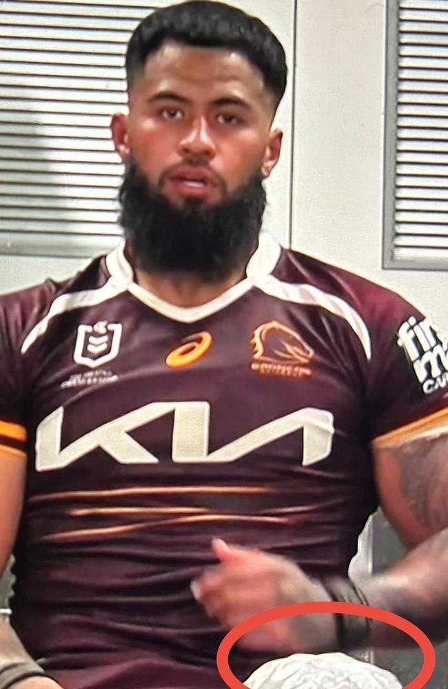NSW and Broncos star Payne Haas with ice on his quad surgery. Pic: Fox League