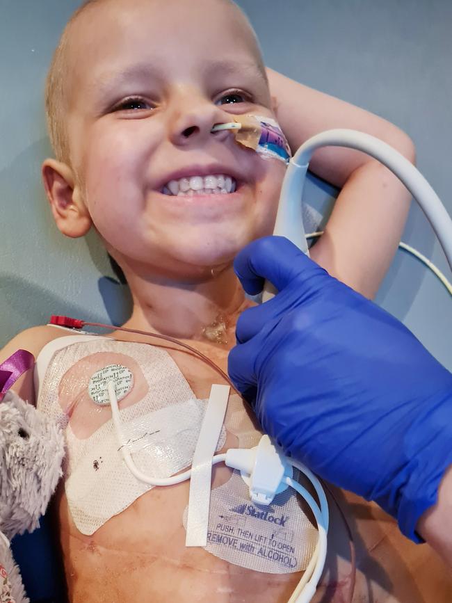 The little girl underwent a marathon procedure. Picture: Supplied