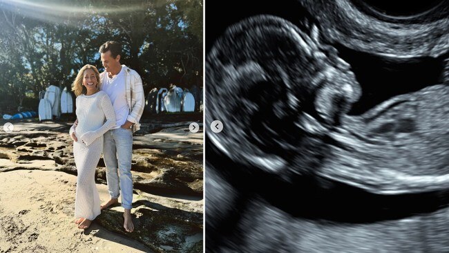 ‘Coming in 2024!’ Bachelor alum makes adorable baby announcement | The ...