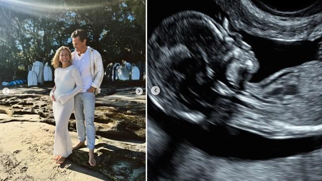 Jimmy Nicholson shared a photo of his partner's ultrasound. Photo: Instagram