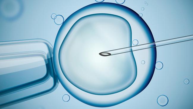 Victorian sperm donors discover they have multiple children | Herald Sun