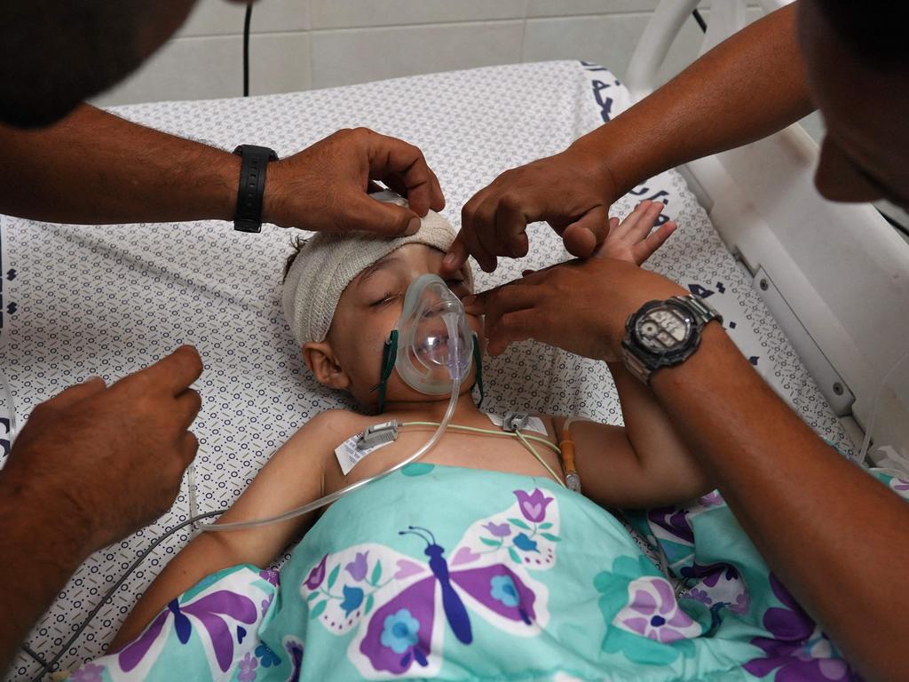 A four-year-old Palestinian child receives medical care at Nasser hospital in Khan Yunis after Israeli bombardment in Rafah. Picture: AFP