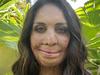 ‘I couldn’t do it all’: Turia Pitt’s brave burnout admission