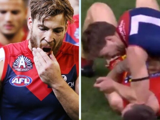 Viney is in hot water over this incident. Image: Getty/Fox Sports