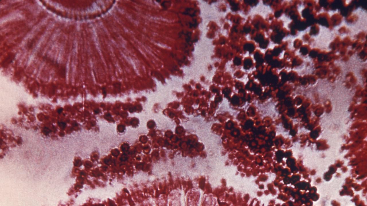 Shocking ‘superbug’ news nobody wanted