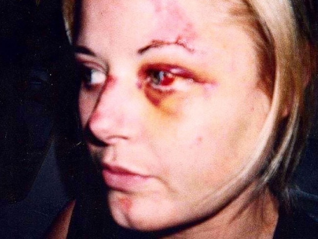 Madeleine West was hit by a bus in 2002.