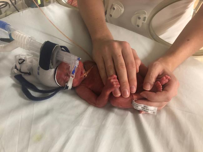 Twins Nash and Reuben were delivered 36 hours after arriving at Mater Mothers’ Hospital, weighing just 900 grams each. Photo/RFDS