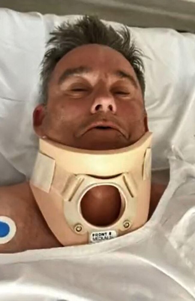 Cyclist Mark Vander in hospital after the incident. Picture: 9 News