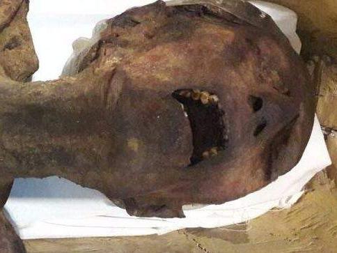 The mystery of the 'Screaming Mummy' has long puzzled archaeologists. It is believed the Mummy was either buried alive or poisoned.Picture: Supplied/ Egyptian Ministry Of Antiquities