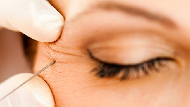 Queensland councils say resources too tight to regulate botox and injectables.