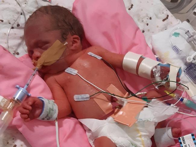 Townsville Mum Jodie Gibson has shared news of the death of baby Nova-Lee Gibson on social media after she had problems with her heart valves.