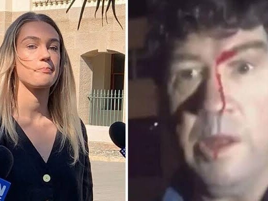 Casey Holmes has inidicated she will plead guilty to assault. Picture: supplied