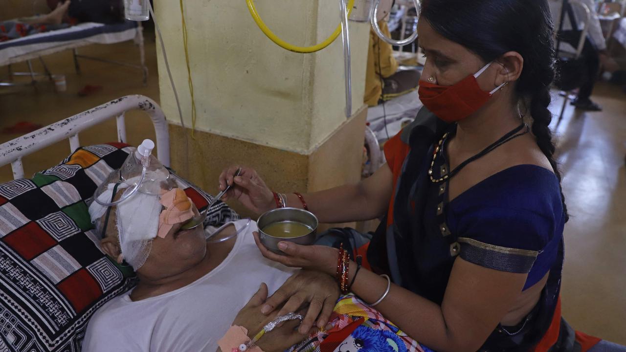 A coronavirus patient infected with the black fungus in Jabalpur in Central India. Picture: Uma Shankar Mishra/AFP