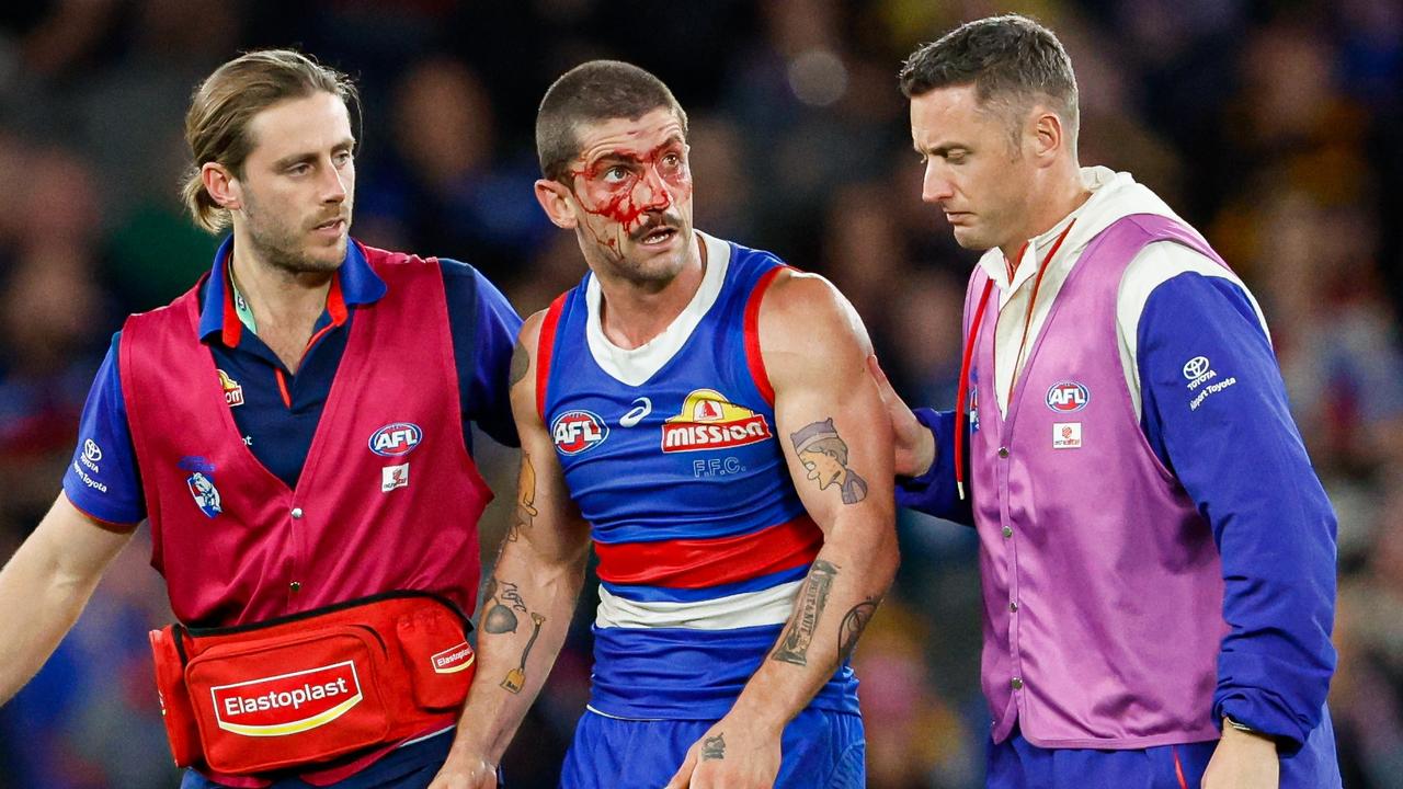 MELBOURNE, AUSTRALIA - MAY 05: Tom Liberatore of the Bulldogs leaves the field under the blood rule during the 2024 AFL Round 08 match between the Western Bulldogs and the Hawthorn Hawks at Marvel Stadium on May 05, 2024 in Melbourne, Australia. (Photo by Dylan Burns/AFL Photos via Getty Images)