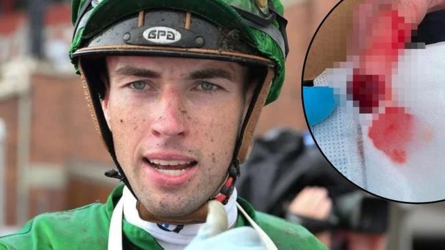 James Orman had the tip of his finger bitten off by a horse on Tuesday morning. Picture: Grant Peters/Trackside Photography.