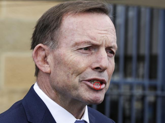 The former PM was left with a busted lip after the attack. Picture: Jim Rice/AAP