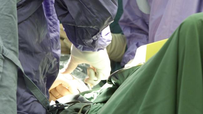 Nearly 1400 Victorians have also died while waiting for elective surgery over the past two years.