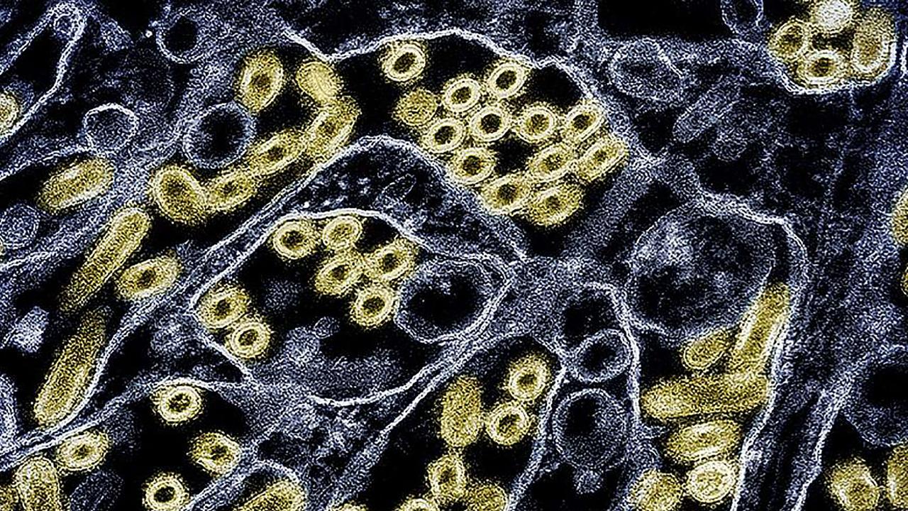 A colorised transmission electron micrograph of the H5N1 virus. Picture: CDC/NIAID/AFP.