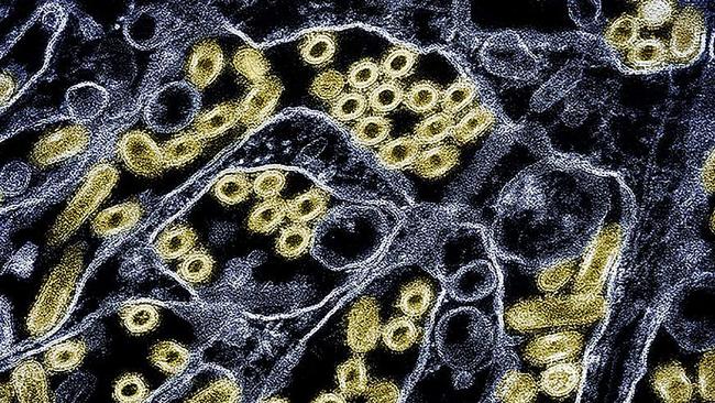 A colorised transmission electron micrograph of the H5N1 virus. Picture: CDC/NIAID/AFP.