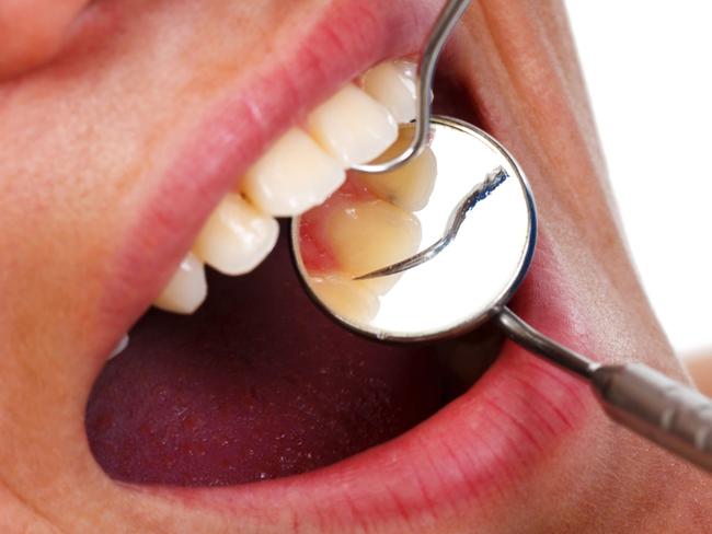 Generic image of dentist working on teeth with mirror.