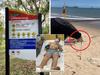 Deadly reason to ‘cover up’ at Aussie beaches