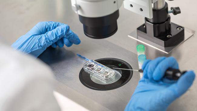 Technician in blue gloves does control check of the in vitro fertilization process using a microscope. Closeup. Horizontal. Picture: Istock