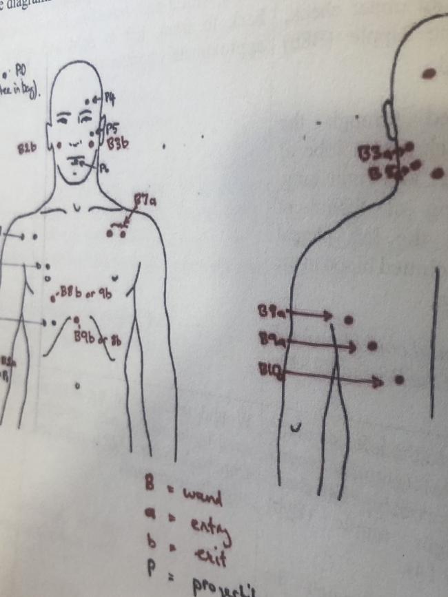 Coroner’s illustration of Pasquale Barbaro’s injuries.