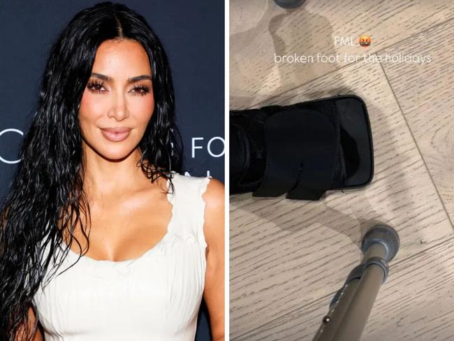 Kim Kardashian has a broken foot.