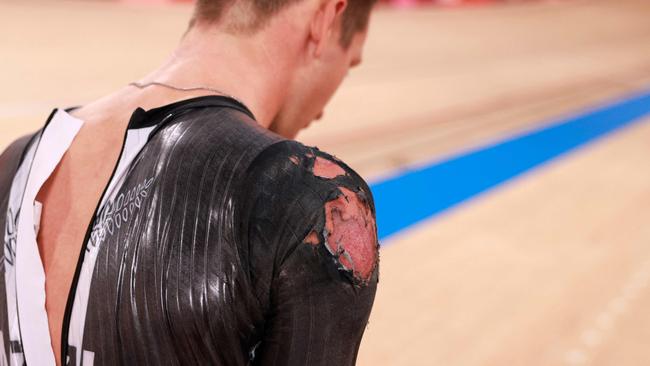 Aaron Gate’s injuries after the crash. Picture: AFP