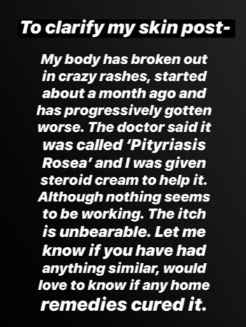 Indy Clinton explains her skin issues.