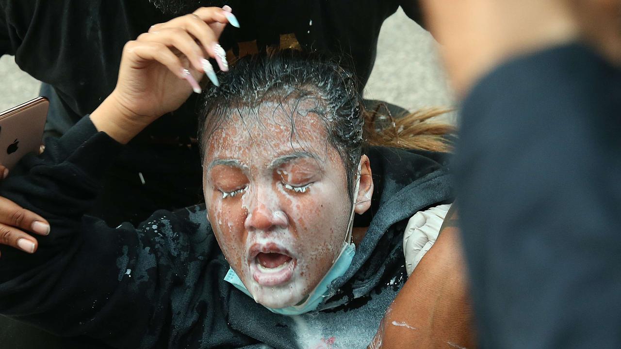 Other protesters doused her in milk to ease the sting of the pepper spray. Picture: Scott Olson/Getty Images/AFP