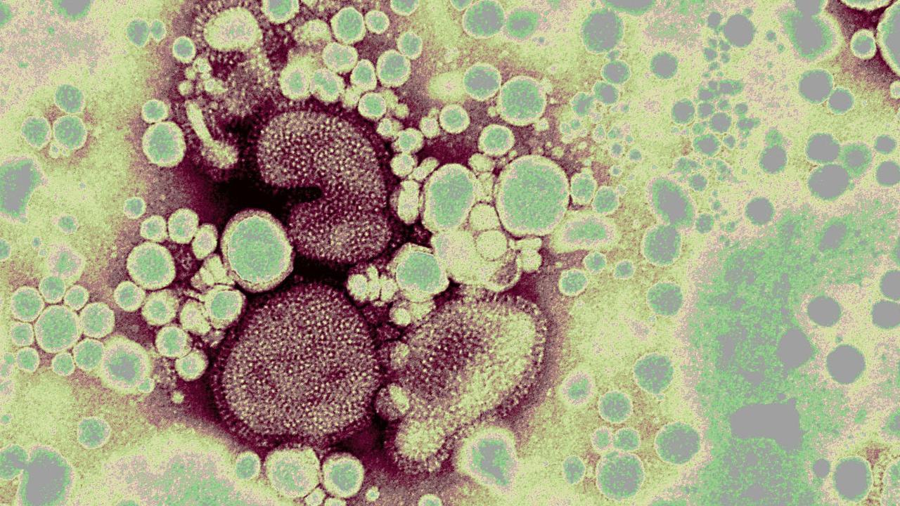 Woman dead as killer virus spreads