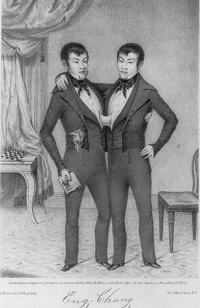 Eng-Chang, the Siamese twins, c. 1830. Picture: Wellcome Collection