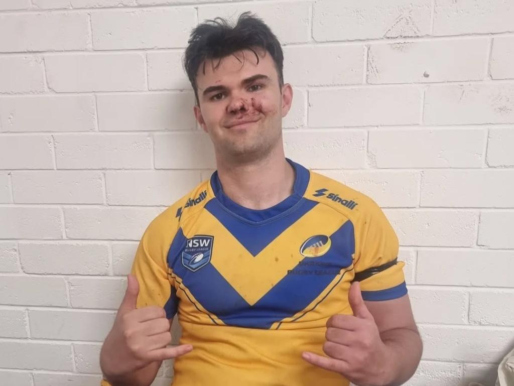 Alex Berger Ukraine rugby league