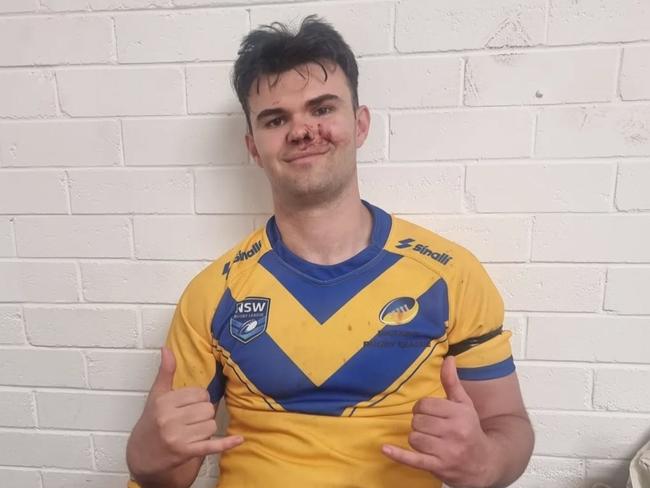 Alex Berger Ukraine rugby league