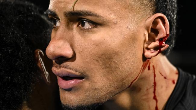 Stephen Crichton’s ear was split in the head clash. Picture: NRL Photos